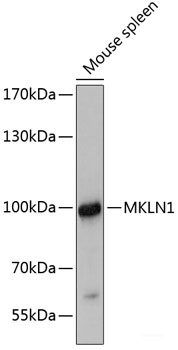 Immunohistochemistry of paraffin-embedded Human lung using IFNG Polyclonal Antibody at dilution of  1:100 (40x lens).
