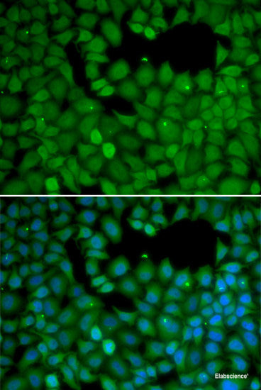 Immunohistochemistry of paraffin-embedded Rat brain using OGDH Polyclonal Antibody at dilution of  1:100 (40x lens).