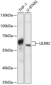 Immunohistochemistry of paraffin-embedded Rat brain using PSMD13 Polyclonal Antibody at dilution of  1:100 (40x lens).