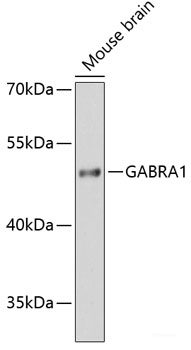 Immunofluorescence analysis of U2OS cells using SFRS9 Polyclonal Antibody at dilution of  1:100. Blue: DAPI for nuclear staining.