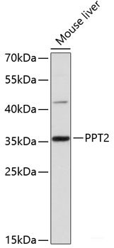 Immunofluorescence analysis of THP-1 cells using TNFRSF10A Polyclonal Antibody at dilution of  1:100 (40x lens). Blue: DAPI for nuclear staining.