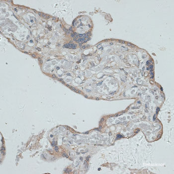 Immunohistochemistry of paraffin-embedded Mouse lung using ARHGEF2 Polyclonal Antibody at dilution of  1:100 (40x lens).