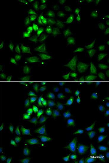Immunohistochemistry of paraffin-embedded Mouse lung using CBX5 Polyclonal Antibody at dilution of  1:100 (40x lens).