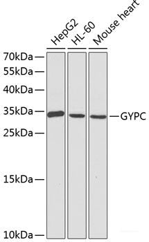 Immunohistochemistry of paraffin-embedded Human colon using METTL13 Polyclonal Antibody at dilution of  1:100 (40x lens).