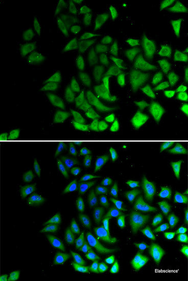 Immunohistochemistry of paraffin-embedded Mouse kidney using TIRAP Polyclonal Antibody at dilution of  1:100 (40x lens).