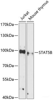 Immunohistochemistry of paraffin-embedded Human stomach using MICA Polyclonal Antibody at dilution of  1:100 (40x lens).