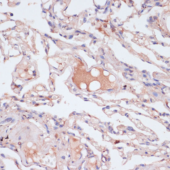 Immunohistochemistry of paraffin-embedded Rat brain using PAX7 Polyclonal Antibody at dilution of  1:100 (40x lens).