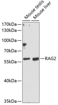 Immunofluorescence analysis of HeLa cells using WDR81 Polyclonal Antibody at dilution of  1:100. Blue: DAPI for nuclear staining.