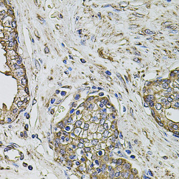 Immunofluorescence analysis of NIH-3T3 cells using ITPR3 Polyclonal Antibody at dilution of  1:100. Blue: DAPI for nuclear staining.