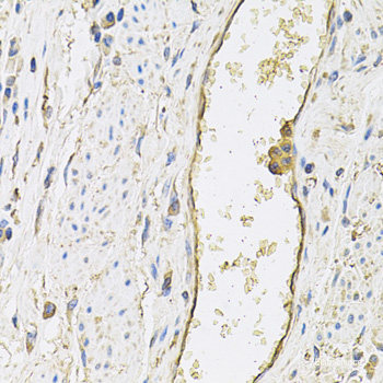 Immunofluorescence analysis of L929 cells using NOS1 Polyclonal Antibody at dilution of  1:100. Blue: DAPI for nuclear staining.
