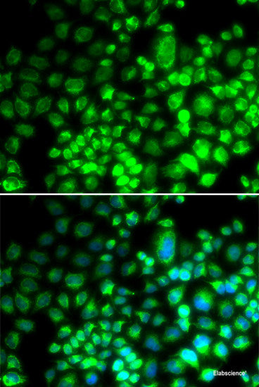 Immunohistochemistry of paraffin-embedded Human liver using ACOX2 Polyclonal Antibody at dilution of  1:100 (40x lens).
