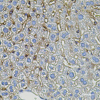 Immunohistochemistry of paraffin-embedded Rat brain using OLIG2 Polyclonal Antibody at dilution of  1:200 (40x lens).