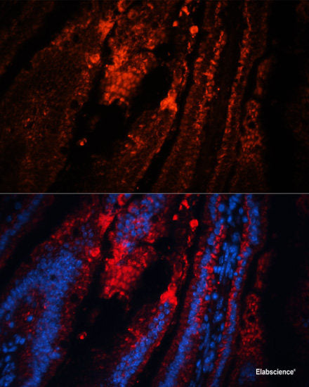 Immunohistochemistry of paraffin-embedded Rat spleen using TP53I11 Polyclonal Antibody at dilution of  1:100 (40x lens).
