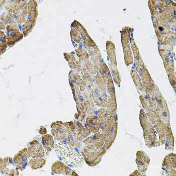 Immunohistochemistry of paraffin-embedded Human lung using C1GALT1 Polyclonal Antibody at dilution of  1:100 (40x lens).