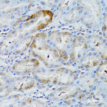 Immunohistochemistry of paraffin-embedded Rat kidney using LTF Polyclonal Antibody at dilution of  1:100 (40x lens).