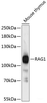 Western blot analysis of extracts of various cell lines using Fibronectin Polyclonal Antibody at dilution of 1:3000.
