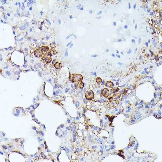 Immunofluorescence analysis of Rat heart using MYH6 Polyclonal Antibody at dilution of  1:100. Blue: DAPI for nuclear staining.