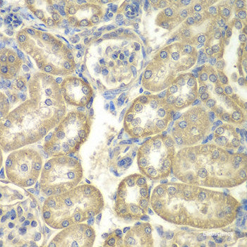 Immunofluorescence analysis of 293T cells using HNRNPH2 Polyclonal Antibody at dilution of  1:100 (40x lens). Blue: DAPI for nuclear staining.