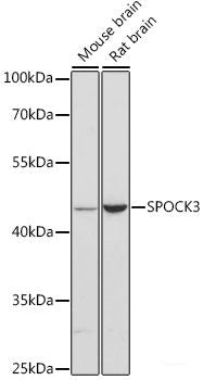 Immunohistochemistry of paraffin-embedded Rat ovary using A1CF Polyclonal Antibody at dilution of  1:100 (40x lens).
