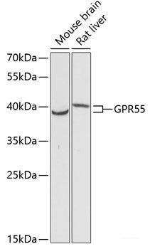 Immunofluorescence analysis of HeLa cells using USP36 Polyclonal Antibody at dilution of  1:100 (40x lens). Blue: DAPI for nuclear staining.