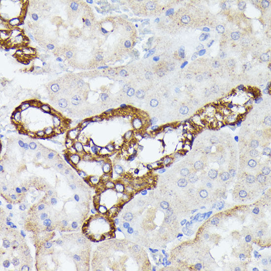 Immunohistochemistry of paraffin-embedded Human tonsil using MUL1 Polyclonal Antibody at dilution of  1:100 (40x lens).