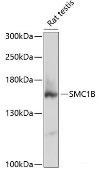 Western blot analysis of extracts of various cell lines using REG4 Polyclonal Antibody at dilution of 1:3000.