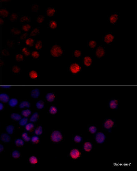 Immunohistochemistry of paraffin-embedded Rat brain using SLC29A1 Polyclonal Antibody at dilution of  1:100 (40x lens).