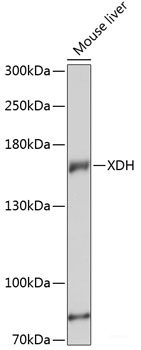 Immunohistochemistry of paraffin-embedded Human liver cancer using AP2A2 Polyclonal Antibody at dilution of  1:200 (40x lens).