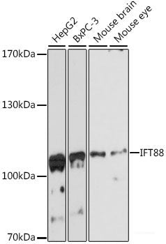 Immunofluorescence analysis of HeLa cells using XIAP Polyclonal Antibody 