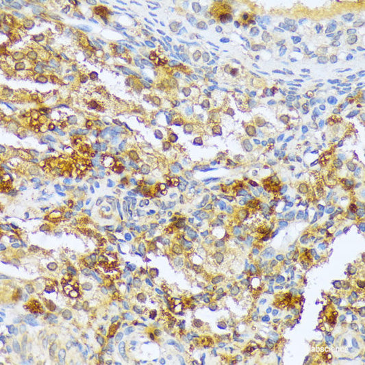 Immunofluorescence analysis of A549 cells using EPHA1 Polyclonal Antibody