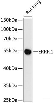 Immunohistochemistry of paraffin-embedded Human breast cancer using CD168 Polyclonal Antibody at dilution of  1:100 (40x lens).