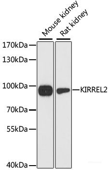Western blot analysis of extracts of NIH/3T3 cells using MAPK3 Polyclonal Antibody at dilution of 1:1000.