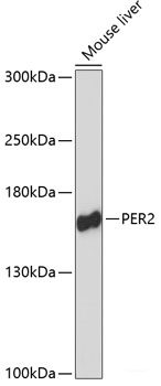 Immunohistochemistry of paraffin-embedded Rat heart using VCP Polyclonal Antibody at dilution of  1:200 (40x lens).