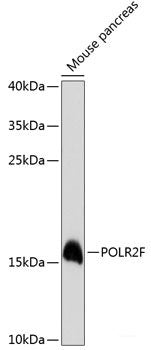 Immunohistochemistry of paraffin-embedded Human prostate cancer using XRCC5 Polyclonal Antibody at dilution of  1:100 (40x lens).