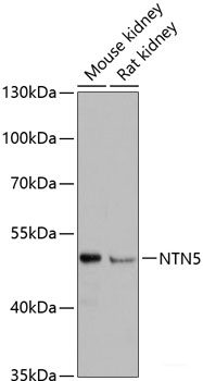 Immunohistochemistry of paraffin-embedded Mouse brain using USP10 Polyclonal Antibody at dilution of  1:100 (40x lens).