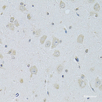 Immunofluorescence analysis of U2OS cells using pum1 Polyclonal Antibody at dilution of  1:100. Blue: DAPI for nuclear staining.