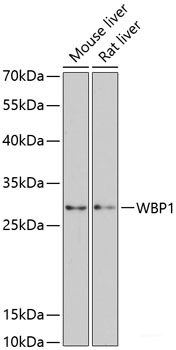 Immunohistochemistry of paraffin-embedded Human stomach using EDIL3 Polyclonal Antibody at dilution of  1:100 (40x lens).