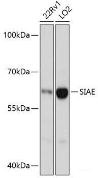 Immunohistochemistry of paraffin-embedded Rat liver using UBD Polyclonal Antibody at dilution of  1:200 (40x lens).