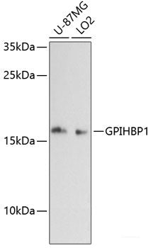 Immunohistochemistry of paraffin-embedded Human prostate cancer using TARDBP Polyclonal Antibody at dilution of  1:100 (40x lens).