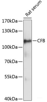 Immunofluorescence analysis of H9C2 cells using RIG-I / DDX58 Polyclonal Antibody at dilution of  1:100. Blue: DAPI for nuclear staining.