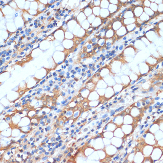 Immunohistochemistry of paraffin-embedded Human stomach using UBIAD1 Polyclonal Antibody at dilution of  1:100 (40x lens).