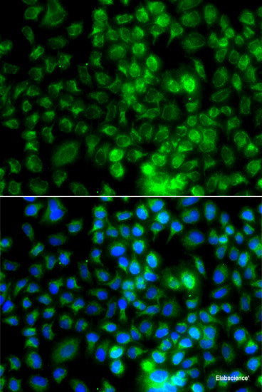 Immunohistochemistry of paraffin-embedded Rat kidney using ACY1 Polyclonal Antibody at dilution of  1:100 (40x lens).