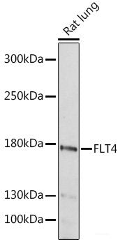 Immunohistochemistry of paraffin-embedded Human liver using HO-1 Polyclonal Antibody at dilution of  1:200 (40x lens).