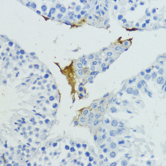 Immunohistochemistry of paraffin-embedded Rat liver using BCL2L2 Polyclonal Antibody at dilution of  1:100 (40x lens).