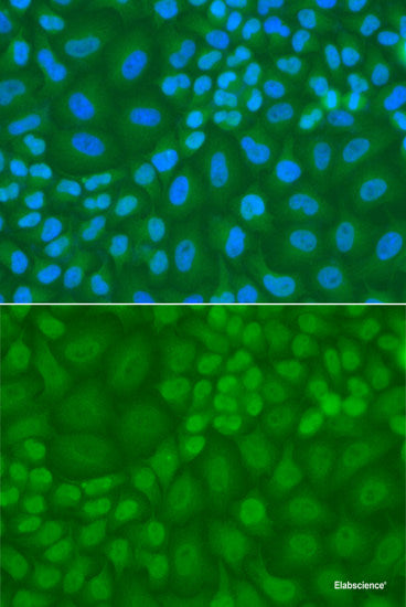 Immunohistochemistry of paraffin-embedded Human kidney using LCP1 Polyclonal Antibody at dilution of  1:100 (40x lens).