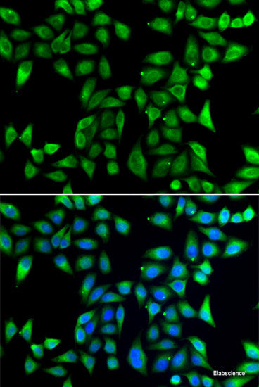 Immunohistochemistry of paraffin-embedded Human stomach using POU2F1 Polyclonal Antibody at dilution of  1:100 (40x lens).