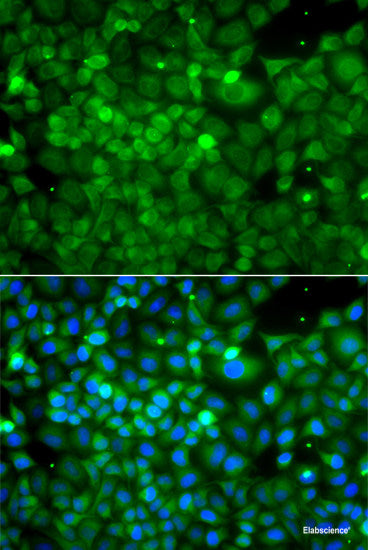 Immunohistochemistry of paraffin-embedded Rat brain using TKT Polyclonal Antibody at dilution of  1:100 (40x lens).
