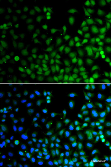Immunohistochemistry of paraffin-embedded Rat kidney using TNFRSF1B Polyclonal Antibody at dilution of  1:200 (40x lens).