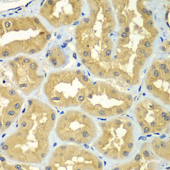 Immunohistochemistry of paraffin-embedded Rat brain using Eif2ak2 Polyclonal Antibody at dilution of  1:200 (40x lens).