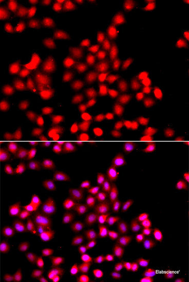 Immunofluorescence analysis of HeLa cells using LSM4 Polyclonal Antibody at dilution of  1:50. Blue: DAPI for nuclear staining.